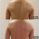 일성약국 | [뽈뽈리뷰]부산 연산동 웨딩관리 리하에스테틱 등관리 후기