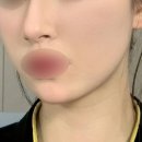 의정부의원 | 의정부 리프팅 빔스테틱의원 후기