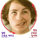 구안와사, 안면 마비, 얼굴 비대칭 예방과 치료 이미지