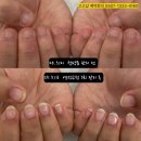 대지메디 | 서울 양천구 물어뜯는 짧은손톱 연장 가격과 후기. 고고샵&amp;오로지푸스