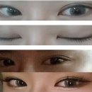 예쁜눈만들기