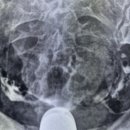 광명방사선과의원 이미지