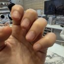 제이네일 | 잠실 석촌역 네일 안녕제이 물어뜯는손톱 교정 리얼후기