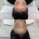 M헤어 티스토리