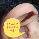 조은소리보청기서울지사 이미지