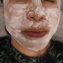 탱탱피부사랑 | 신사역피부과 흑자 리팟레이저 후기, 엄마 피부 되찾아 드린 내돈내산 솔직 변화