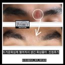 얼굴 미간 왁싱화상도 말끔히 진정케어로 관리후기 [제주/제이포레에스테틱]