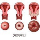 경부전기 이미지