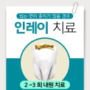 상아치과재료 이미지