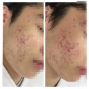 제주피부관리더베러 네이버블로그
