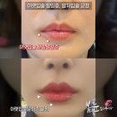 봄눈피우다의원 이미지