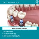 김포치과기공소 이미지