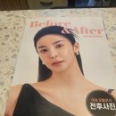 숨은그림성형외과의원 | 모모성형외과의원 방문상담 아 고민되네요ㅎㅎ