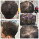 HAIR 덕분愛