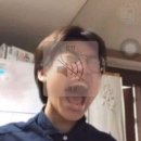 (주)이씨엠디 강동경희대병원장례식장 | 에프엑스-첫사랑니 발치후기