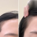 제이케이두피부띠크(JK두피부띠크)