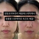 파리바게뜨 영등포점 | 영등포피부관리 해움에스테틱에서 맞춤형 수분케어로 속건조 해결!