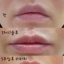 디아트의원 이미지