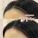라인헤어 | [부천] 부천 왁싱 잘하는 곳 헤어라인 왁싱 후기, 주블리왁싱