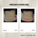 하계역] 웨딩 전 예신이들 누빼관리(누워서 빼는 관리) 받기 좋은 리메디뷰티 아카데미 본점 솔직 후기!