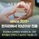 고은이(e)플란트치과의원 | 용강동치과 씹을 때 찌릿하다면