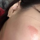 초당요양병원 | 저혈압의 역마살의 난리난리의 여자의 9월 2주
