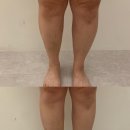 이레테라피 | 창원 상남동 하체관리 제대로 받고 온 후기