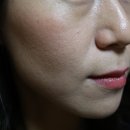 리치팰리스 | 부천 피부관리 추천::수앤수뷰티끄 연예인필 네오필 바이오필링 4회차 후기