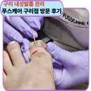 푸스케어 - 서구 청라루비로 76 | 구리 내성발톱 관리 고민이라면 푸스케어 구리점 내돈내산 방문 후기