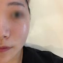 온막지 | 충주 홍조관리 세아로움:) 세맨시트케어 받고 온 솔직후기 대만족
