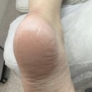 푸스케어 파주운정점(라푼젤네일)