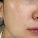 미즈코스메틱 - 광명시 일직로 43 | 톤업크림 파우더크림 전문에스테틱 사용제품 '휴템셀 파우더 크림' 후기