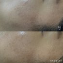 완산-17 | 촉촉한 전주피부관리 받고 온 에스테티아 전주완산1호점 후기