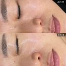 킨 메디칼(kin medical) | 대전 피부관리 봉명동 리미크스킨 유성봉명본점 (세멘시트 탄력관리 노화관리)