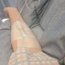 천자로 | 시험관 난자 채취 32개 후기! 복수천자 없이 과배란 자극 증후군 극복한 관리 비법