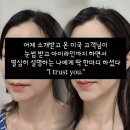 눈썹