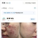 수디끌스킨