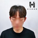 히스애즈