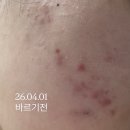 메디인 | 메디인랩 A3앰플 여드름 탈출 후기!!