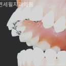 서울윌치과의원 이미지