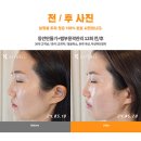 연인체형관리