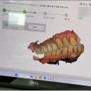협진부분정비 | 홍대입구역 치과, 신중한 선택이 필요한 이유