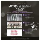행복한예일치과의원 네이버블로그