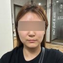 칠곡본한의원 | 대구피부관리샵 에스테틱 추천 &lt;정명순내면미용&gt; 작은얼굴 얼굴비대칭 윤곽 관리 후기 (1회차)