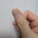나의발톱일기 | 나의일기)tc항암2~4차 후기 항암 끝