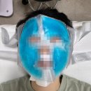 강남-147 | 역삼역 미작뷰티 강남본점 잡티제거 매우만족 후기