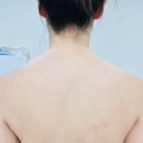 더라움네일 | 금호동 목어깨관리 라움더뷰티 상체리셋케어 감동후기(승모근 비포에프터)