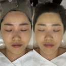 양지메디컬 | 파주 피부관리 H.뷰티리움 파주 플리즈마 부스터 관리후기