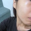 피부장벽 회복을 도와주는 세라마이드 크림 후기