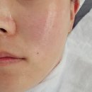 죽하로 | [제천 장락동] 피부관리 숨 후기 ｜홍조 잡는 진정 쿨 관리 과정 솔직후기